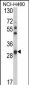 GSTO1 Antibody (Center)